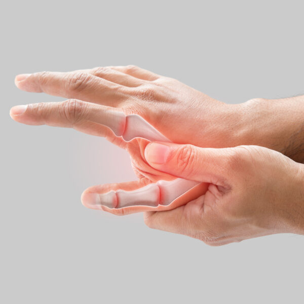 A man has a sore palm because of inflammation of the finger bone.