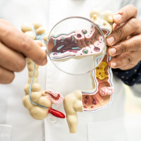 63. Qué factores afectan a la microbiota intestinal